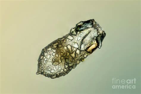  Testate Amoeba!  A Microscopic Marvel Resembling Tiny, Exquisitely Crafted Houses